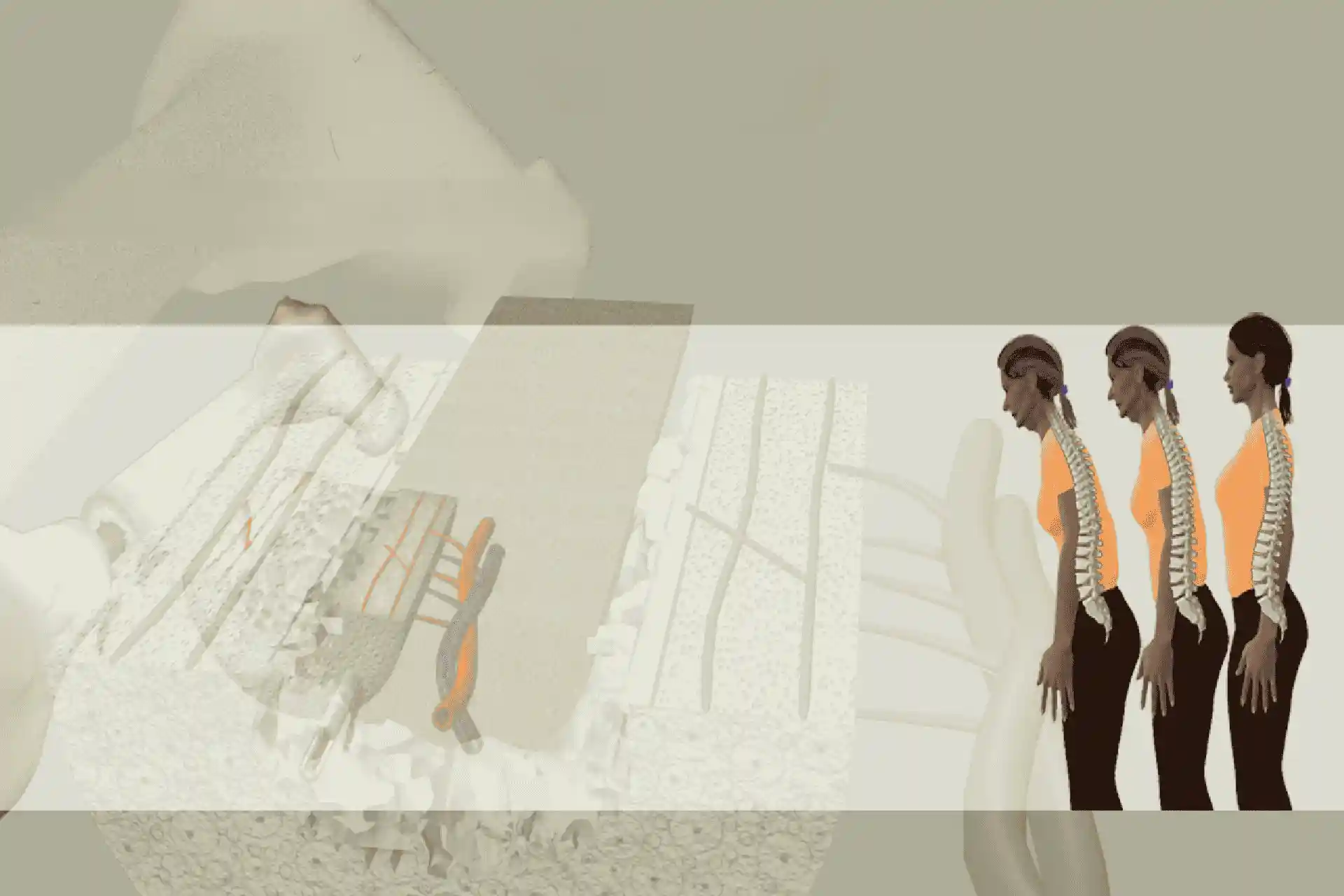 postmenopausal osteoporosis